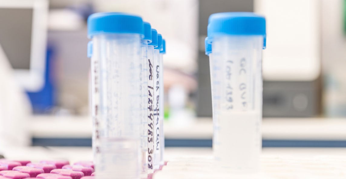 plastic-rack-with-plastic-test-tubes